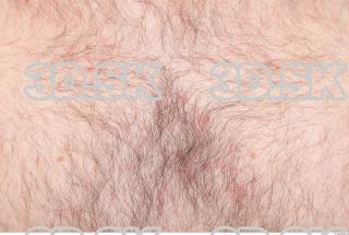 Skin texture of Elbert  0001